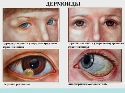 Детская офтальмология в Одинцово | Лечение глаз у детей
