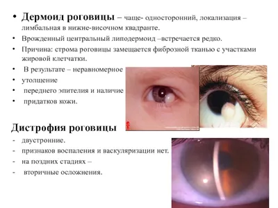 Опухоли органа зрения - презентация онлайн