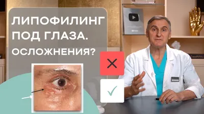 Липофилинг лица, цена в Москве процедуры липофилинга глаз, скул,  подбородка, лба, носа и щек
