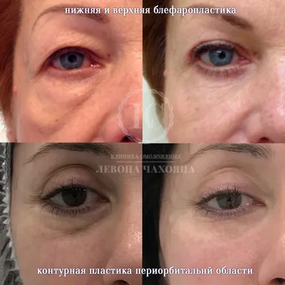 Процедуры инъекции липолитиков от 1990 руб/мл - BeautyWay Clinic 8 (499)  393-36-16