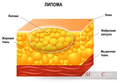 Шишка у кошки: на животе, шее, голове и других местах: симптомы, лечение  опухоли