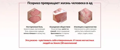 Лишай: причины, виды, симптомы, диагностика и лечение всех видов лишая у  человека в Москве - сеть клиник «Ниармедик»