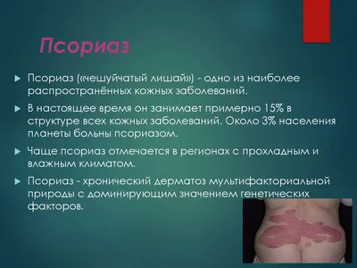 On Clinic Bishkek - Псориаз (чешуйчатый лишай) — воспалительное заболевание  кожи, возникающее в результате нарушения созревания клеток кожи,  характеризующееся многообразными проявлениями. Доказан наследственный  фактор развития болезни. Болезнь не ...