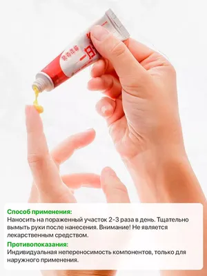 Экзема Псориаз Кожи Мужской Hand Male Руки Псориазом Болезни Медицинская  стоковое фото ©nkooume 437001952