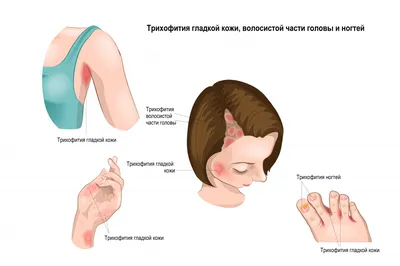 Skinetika - Среди широко распространенных сегодня... | Facebook