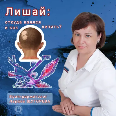 Лечение псориаза (чешуйчатого лишая) в Киеве — Derma.ua