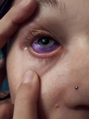 Канадская модель начала слепнуть, сделав татуировку на глазу