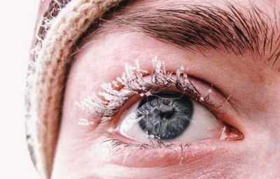 Лечение холодовой аллергии в клинике в Москве - метро Дмитровская,  Тимирязевская