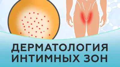 Чем лечить лишай? ~ Советы специалистов