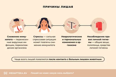 Лечение розового лишая (лишая Жибера) в Киеве — Derma.ua
