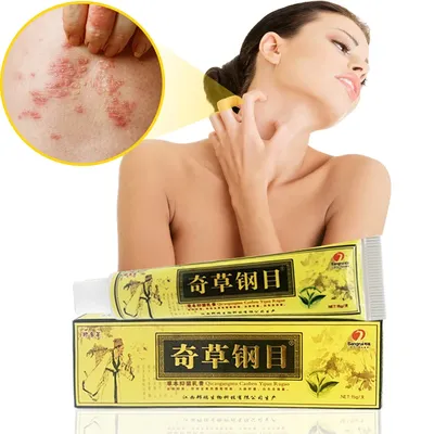 https://www.kiz.ru/content/zdorove/zabolevaniya/est-nyuansy-chem-psoriaz-otlichaetsya-ot-ekzemy-i-dermatita-/