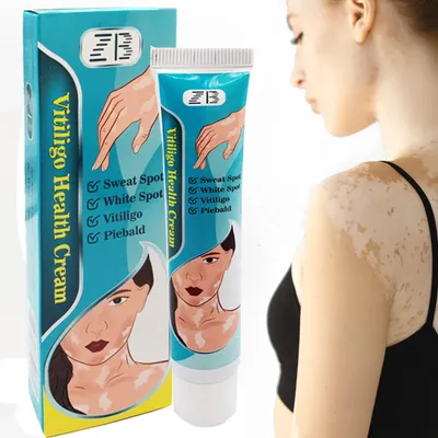 ZB Vitiligo Крем для лечения пятна пота пьебалд удаление травяная медицина  Штукатурка версоколор Pityriasis Eczma лечение бальзам для ухода за кожей |  AliExpress