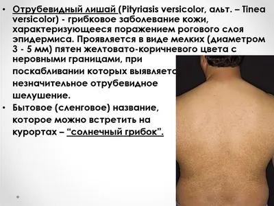 Лишай отрубевидный (Pityriasis versicolor, tinea versicolor) реферат по  медицине | Сочинения Медицина | Docsity