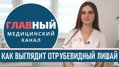 Если вам выставили диагноз отрубевидный или разноцветный лишай, солнечный  грибок, Tinea flava или Lichen versicolor, то знайте, что это все… |  Instagram