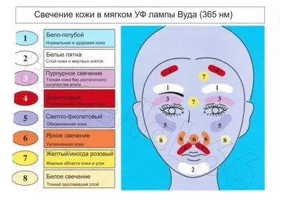 Внимание, очень заразно «Стригущий лишай»! (О КОТЯТАХ И НЕ ТОЛЬКО…) |  31.10.2019 | Ирбит - БезФормата