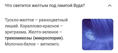 Лампа Вуда » Клиника косметологии и дерматологии «ACADEMY» — лечение кожи и  волос.