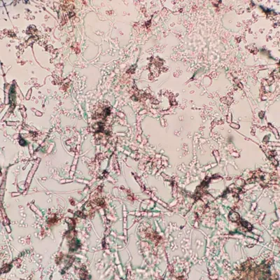 Грибок мукора под микроскопом | Статьи на сайте Познавая Мир