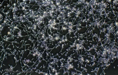 Грибок Dermatphyte под микроскопом Стоковое Фото - изображение  насчитывающей наука, здоровье: 177852538