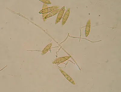 Лишайники под микроскопом | Пикабу