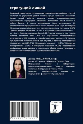 Выпадение волос у детей – лечение | Всё о причинах выпадения волос у детей