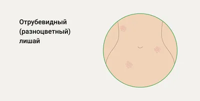 У ребёнка сыпь по всему телу. Куда бежать – к аллергологу, педиатру или  кожнику? | Новости Таджикистана ASIA-Plus