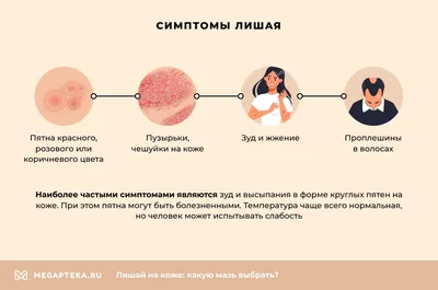 Опоясывающий лишай (опоясывающий герпес, herpes zoster): симптомы и  профилактика