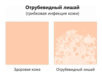 SOS! Девочки, что это может быть на голове у ребенка? - ответы с 60 по 90 -  Советчица