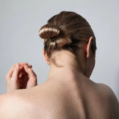 Сыпь на внутренней стороне бедра – причины, лечение, фото