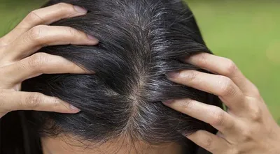 Выпадение волос от стресса: что делать и как лечить, если выпадают волосы  от стресса – Лаборатория Ан-Тек