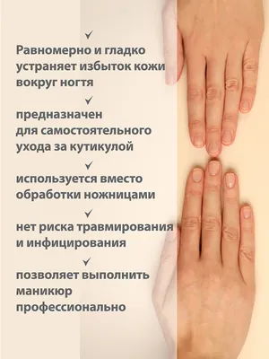 Масло для ногтей и кожи Onistop Nails Of The Day (для лечения онихолизиса)  15 мл (S-ND) (арт.28333 ) ➤ Купить по цене 245грн с доставкой по Украине -  Limonad