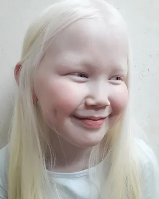 альбиносы цвет глаз｜Поиск в TikTok