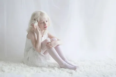 Зожник | 33 фото и 18 фактов об альбиносах
