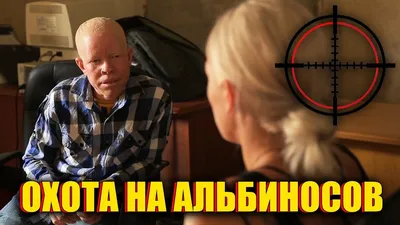 Лунная красота: как живет девушка-альбинос из Челябинска | Пикабу