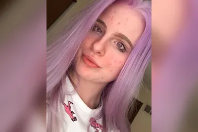 Девушка-альбинос с фиолетовыми глазами покорила соцсети своей внешностью -  Газета.Ru | Новости