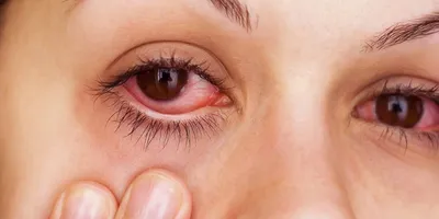 Почему у людей на фото красные глаза | Пикабу