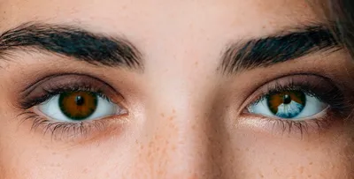 Что такое гетерохромия, как она выглядит и почему появляется разный цвет  глаз