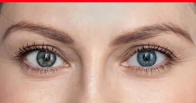 Глаза разного цвета (гетерохромия) | Первая глазная клиника в Москве | Дзен