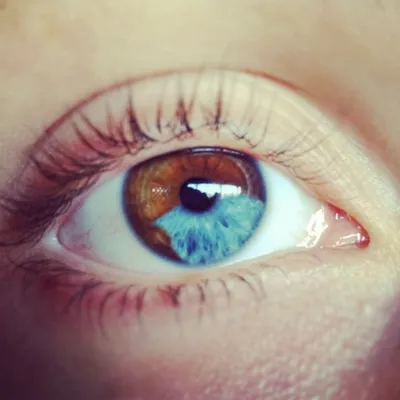 Как генетическая наследственность влияет на цвет глаз