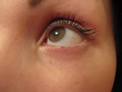 Что такое гетерохромия, как она выглядит и почему появляется разный цвет  глаз