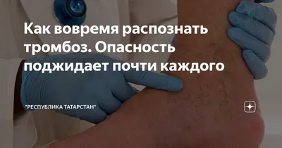 Почему болят вены на руках | причины, симптомы и основные принципы лечения