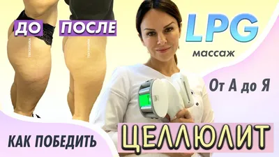 Результаты после LPG-массажа, отзывы и фото до и после ЛПДЖИ массажа