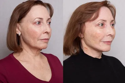 Почему Памела Андерсон перестала делать макияж после 55 лет: очень  печальная причина
