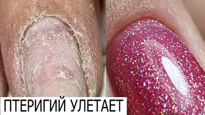 Макро маникюр 💅🏼 Мастер Ирина 💖 Семашко 113 📍 ______ #ногтиростов  #ростовногти #маникюрростов #ногтивростове #салонростов… | Instagram