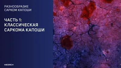 On the issue of tolerability and safety of phototherapy in patients with  psoriasis - Olisova - Russian Journal of Skin and Venereal Diseases