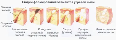 Прыщ на десне: причины, осложнения, лечение — клиника Доктора Федорова