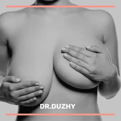 Маммопластика — виды операций на груди, особенности подбора размера  имплантов и проведение операции в MajorBeauty