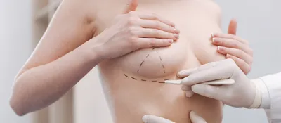 Повторная маммопластика - цены на вторичную операцию груди в СПб