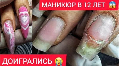 Ногти для 12 лет | Nail designs valentines, Trendy nails, Valentine's day  nail designs