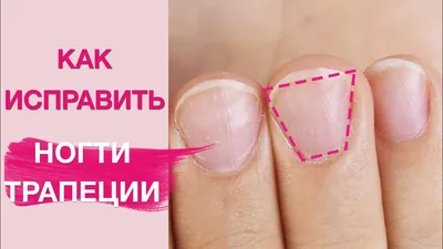 Manicure on Short Trapezoidal Nails | How to Fix Them - YouTube