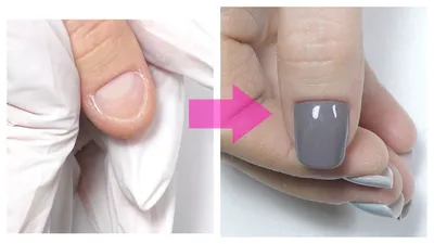 Nail IndasTriss - ОНИ НЕ НАРОЩЕННЫЕ 😱 ⠀ Ставь 💞 и читай ⠀ Вы только  посмотрите на них! Динамика - 6 месяцев. ⠀ До - тонкие обгрызанные ломкие  ногтки и огромное желание